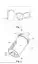 Fig. 02 - THE COMBINATION OF A PHYSICAL MODEL OF A SET OF A PATIENT'S TEETH AND AN ELONGATED IMPLANT ANALOG, AN ELONGATED IMPLANT ANALOG AND A METHOD OF MAKING A PHYSICAL MODEL OF A SET OF TEETH