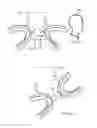 Fig. 02 - Apparatus for user having teeth
