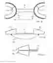 Fig. 03 - Apparatus for user having teeth