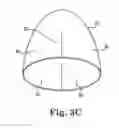 Fig. 05 - Method of treating prolapse of a vagina by providing an implant inside of the vagina