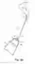 Fig. 15 - Method of treating prolapse of a vagina by providing an implant inside of the vagina