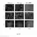 Fig. 15 - Scaffolds for soft tissue and uses thereof