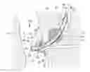 Fig. 01 - Stent