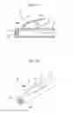 Fig. 07 - Stent
