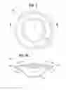 Fig. 03 - Accommodating intraocular lens