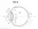 Fig. 07 - Accommodating intraocular lens