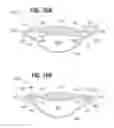 Fig. 10 - Accommodating intraocular lens