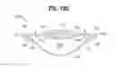 Fig. 11 - Accommodating intraocular lens
