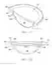 Fig. 12 - Accommodating intraocular lens