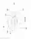 Fig. 11 - Accommodating intraocular lens providing progressive power change