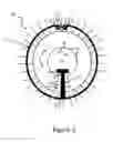 Fig. 03 - Exocapsular device and method for lens stabilization