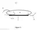 Fig. 04 - Exocapsular device and method for lens stabilization