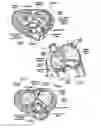 Fig. 03 - Methods of implanting a heart valve at an aortic annulus