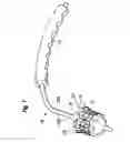 Fig. 05 - Methods of implanting a heart valve at an aortic annulus