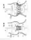Fig. 08 - Methods of implanting a heart valve at an aortic annulus