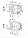 Fig. 14 - Methods of implanting a heart valve at an aortic annulus