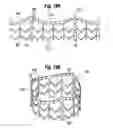 Fig. 16 - Methods of implanting a heart valve at an aortic annulus