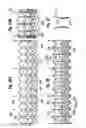Fig. 19 - Methods of implanting a heart valve at an aortic annulus
