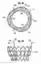 Fig. 20 - Methods of implanting a heart valve at an aortic annulus