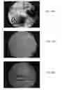 Fig. 08 - BONE GRAFT MATERIALS AND METHODS
