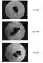 Fig. 18 - BONE GRAFT MATERIALS AND METHODS