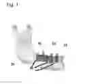 Fig. 04 - SCAFFOLD IMPLANT SYSTEM