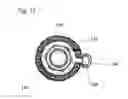 Fig. 14 - SCAFFOLD IMPLANT SYSTEM