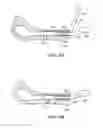 Fig. 12 - Systems and methods for joint stabilization