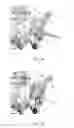 Fig. 15 - Sacroiliac fusion system