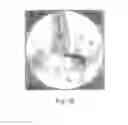 Fig. 18 - Sacroiliac fusion system