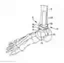 Fig. 01 - Talar dome fixation stem