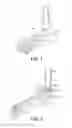 Fig. 02 - Talar dome fixation stem