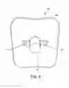 Fig. 04 - Talar dome fixation stem