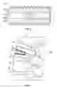 Fig. 03 - System and method for correcting scoliosis