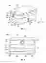Fig. 06 - System and method for correcting scoliosis