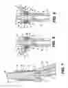 Fig. 04 - Spinal implants and instruments