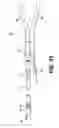 Fig. 07 - Spinal implants and instruments