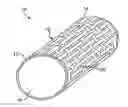 Fig. 01 - Degradable implantable medical devices