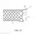 Fig. 07 - Integrated stent repositioning and retrieval loop