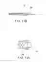 Fig. 08 - Integrated stent repositioning and retrieval loop
