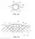 Fig. 10 - Integrated stent repositioning and retrieval loop