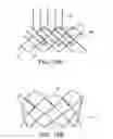 Fig. 13 - Integrated stent repositioning and retrieval loop