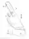 Fig. 25 - Methods and systems for delivering an implant using a planetary gear actuation assembly