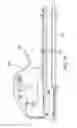 Fig. 26 - Methods and systems for delivering an implant using a planetary gear actuation assembly