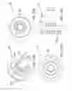 Fig. 28 - Methods and systems for delivering an implant using a planetary gear actuation assembly