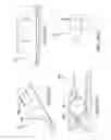Fig. 32 - Methods and systems for delivering an implant using a planetary gear actuation assembly