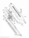 Fig. 47 - Methods and systems for delivering an implant using a planetary gear actuation assembly