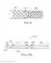 Fig. 13 - BI-DIRECTIONAL STENT DELIVERY SYSTEM