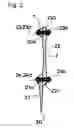 Fig. 03 - Ingrown nail correcting device