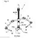 Fig. 04 - Ingrown nail correcting device